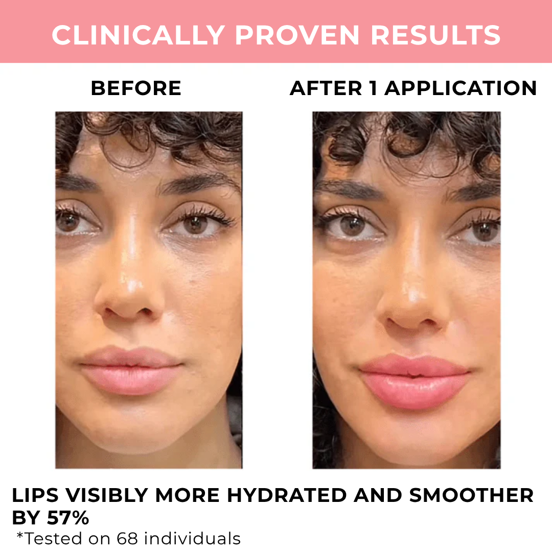Lumpy Lip Boost™ | Lip Volume Treatment